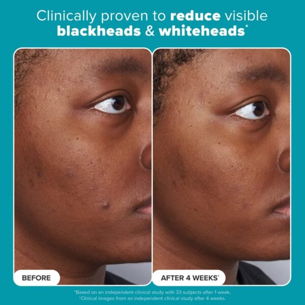 (New orignal ) Paula's Choice SKIN PERFECTING 2% BHA Liquid Salicylic Acid Exfoliant 118ml - Image 6