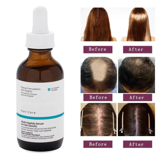 [ ORIGINAL US ] Ordinary Multi Peptide Serum for Hair Density (for thicker, fuller hair) 60ml - Image 9
