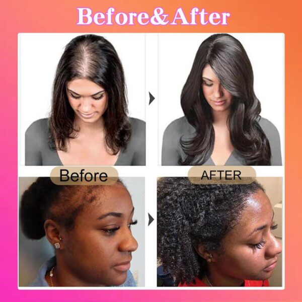 Sauvasine Raw Batana Hair Serum - Image 4