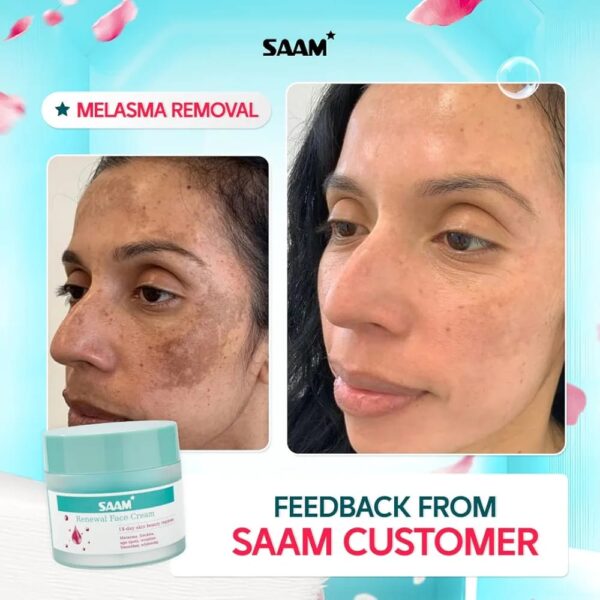 SAAM Renewal Face Cream | Melasma, Freckles, Age Spots & Dark Spots | With Alpha Arbutin and Kojic Acid | - Image 6