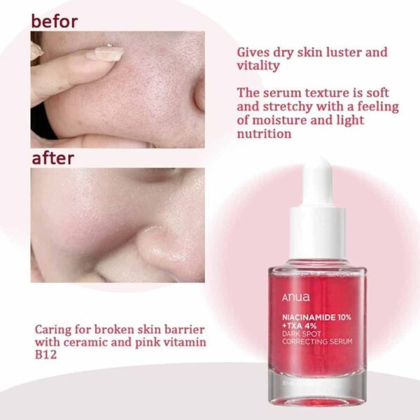 (ORIGINAL)ANUA Niacinamide 10% + TXA 4% Dark Spot Correcting Serum 30ml - Image 5
