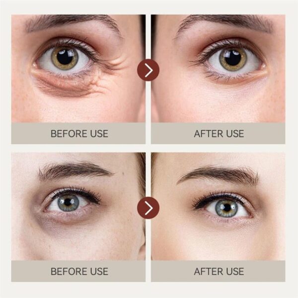 IREV RETINOL EYE CREAM - Image 8