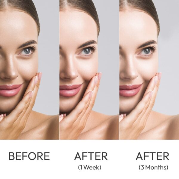 Kojie San Soap 65g x 3 (Triple Pack) - Skin Brightening & Lightening - Image 4
