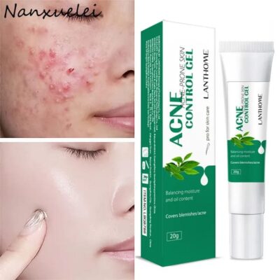 (Original)LANTHOME  Tea Tree Acne Gel