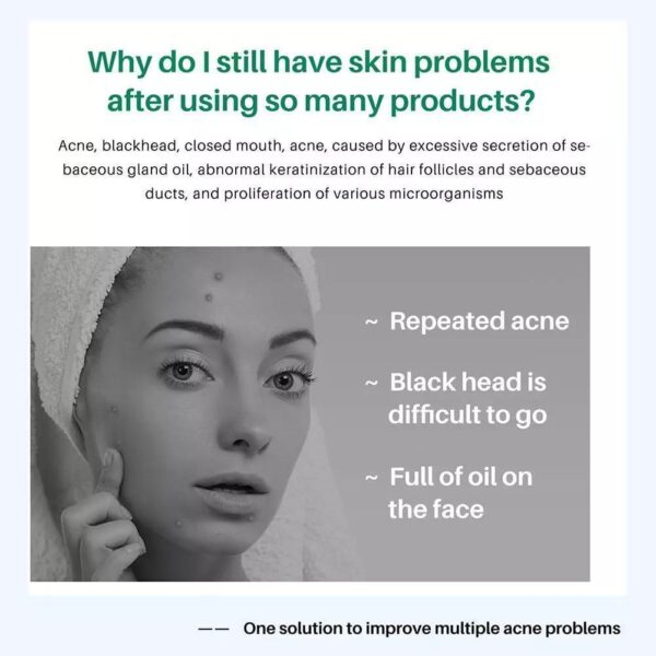 (Original)LANTHOME  Tea Tree Acne Gel - Image 4