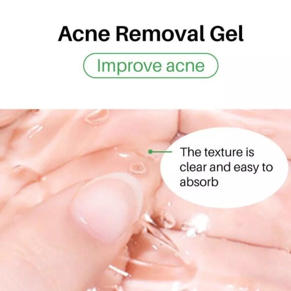 (Original)LANTHOME  Tea Tree Acne Gel - Image 5