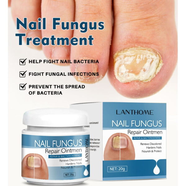 (Original)LANTHOME Nail Treatments Serums Cream Care Foot Care Nail Fungus Treatments Serums Nail Shine Nail Repair Cream - Image 2