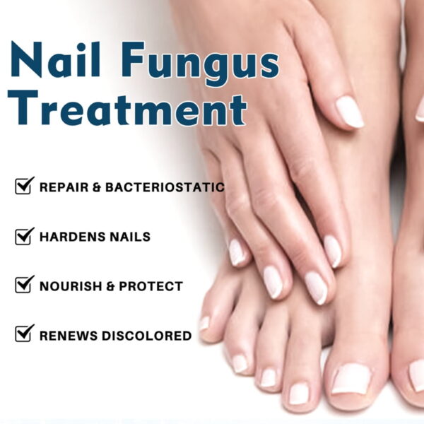 (Original)LANTHOME Nail Treatments Serums Cream Care Foot Care Nail Fungus Treatments Serums Nail Shine Nail Repair Cream - Image 3