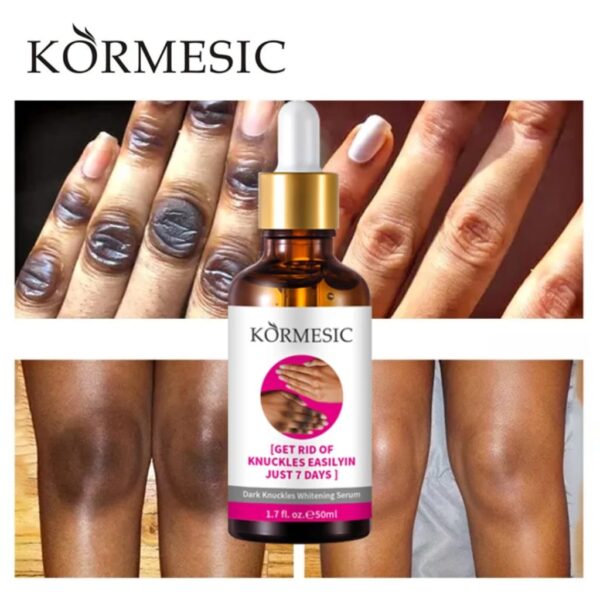 KORMESIC Dark Knuckle whitening Brightening Serum 50ml - Image 6