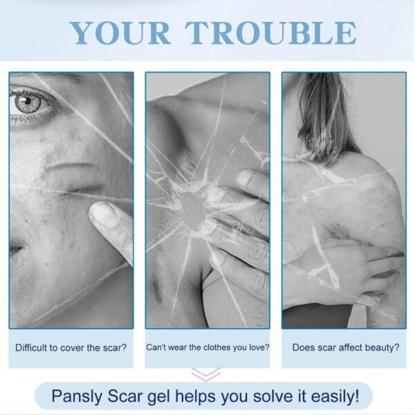 (New orignal)PANSLY ADVANCED SCAR GEL - Image 3