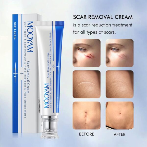 MOOYAM Skin Repair and Scar Removal Cream - Image 2