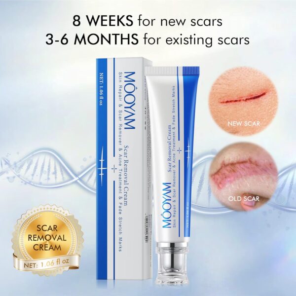 MOOYAM Skin Repair and Scar Removal Cream - Image 3
