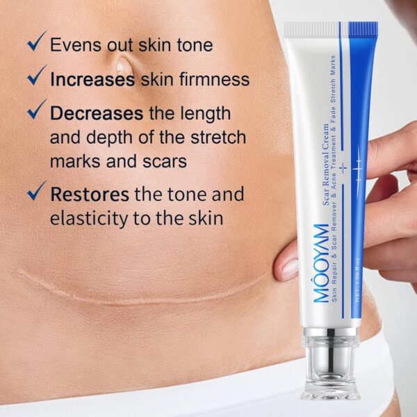 MOOYAM Skin Repair and Scar Removal Cream - Image 4