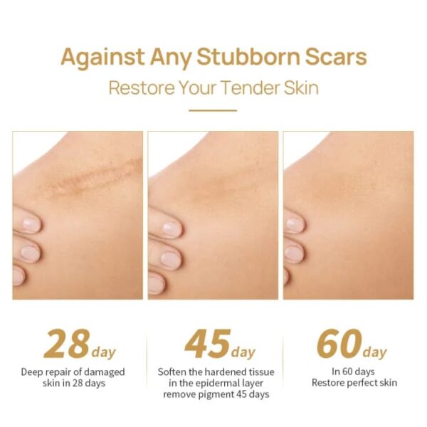 LANBENA Scar Removal and Stretch Marks Cream (Acne Scar Remover Set) - 3PCS - Image 8