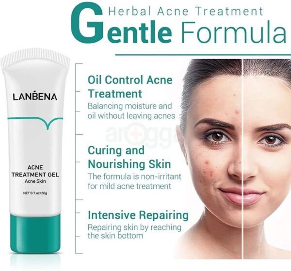 (New orignal)Lanbena Acne Treatment Gel Facial cleansing gel with tea tree extract. 20g. - Image 4