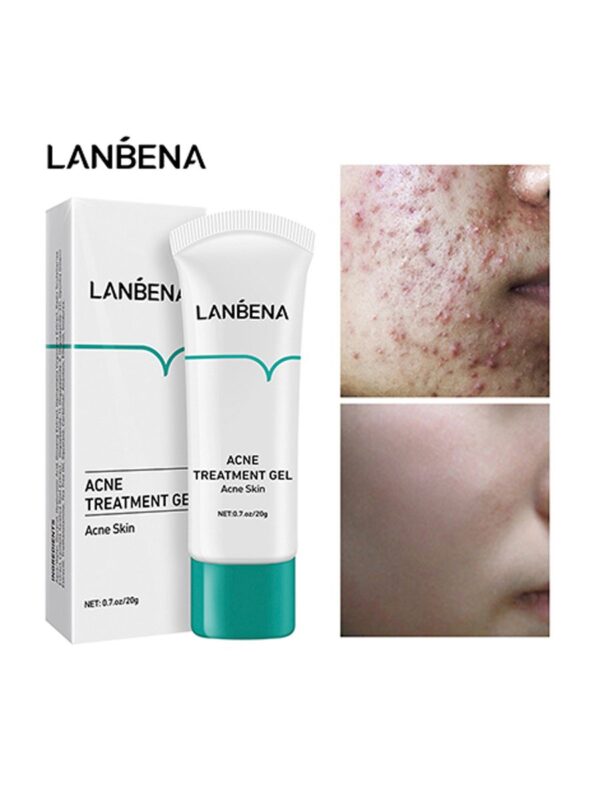 (New orignal)Lanbena Acne Treatment Gel Facial cleansing gel with tea tree extract. 20g. - Image 9
