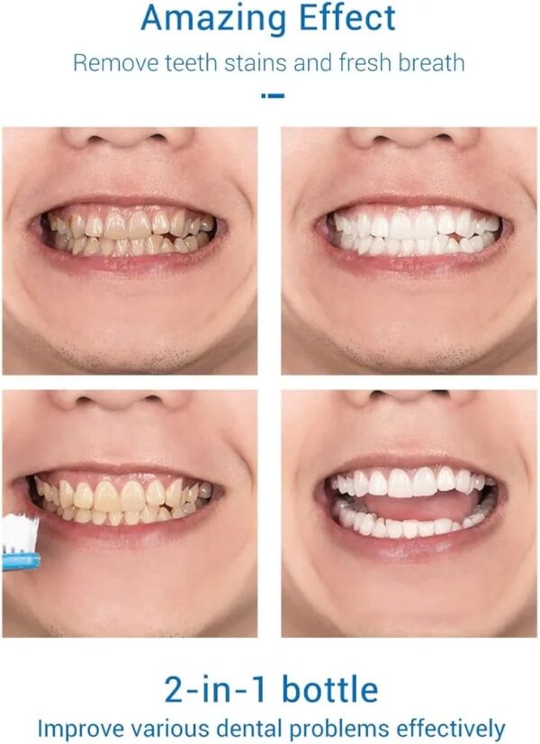 (Original)Lanbena Teeth Whitening Mousse Toothpaste - Image 6