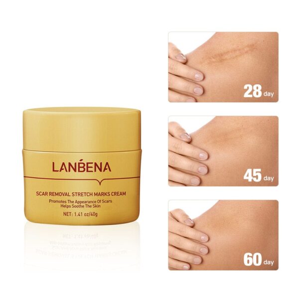 (New)Lanbena  Scar Remover Cream - Image 3