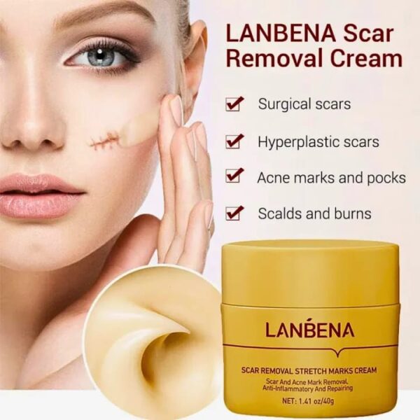 (New)Lanbena  Scar Remover Cream - Image 5