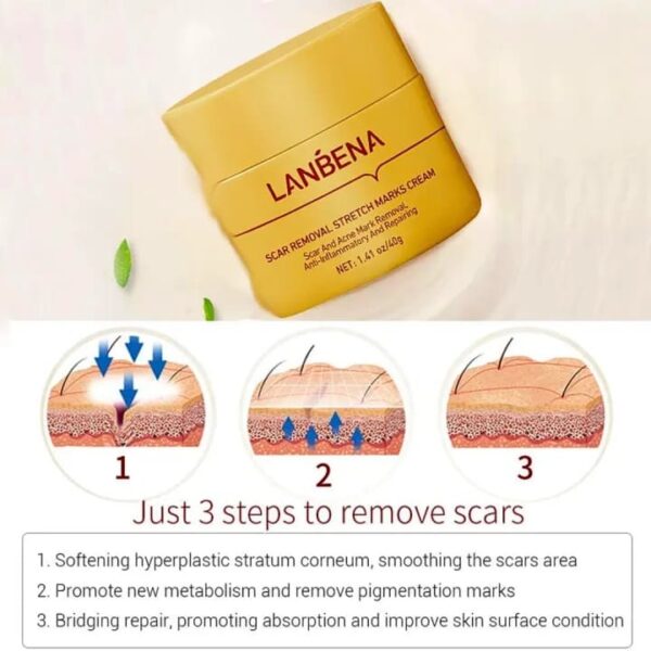 (New)Lanbena  Scar Remover Cream - Image 4