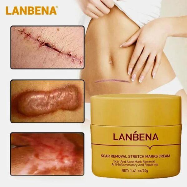 (New)Lanbena  Scar Remover Cream - Image 7