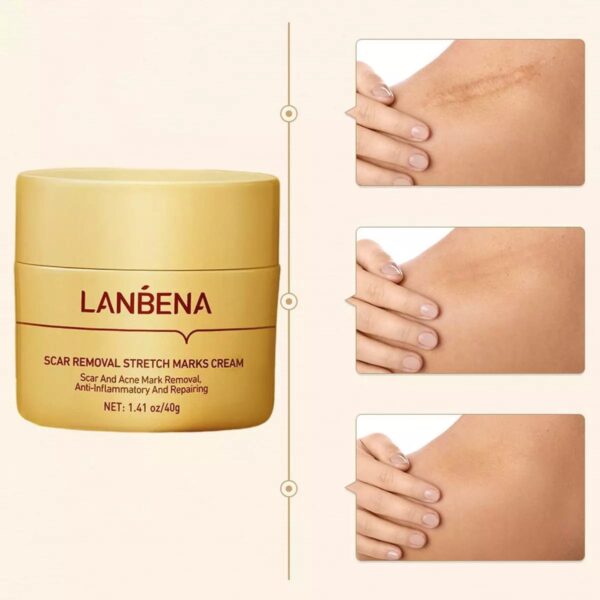 (New)Lanbena  Scar Remover Cream - Image 9