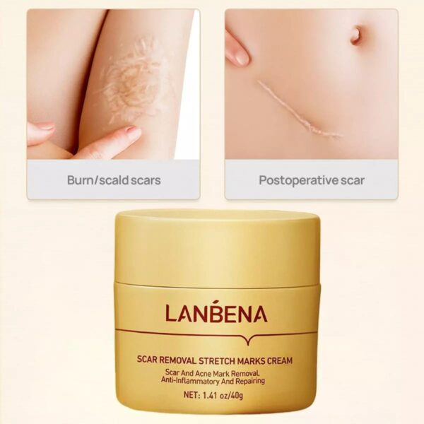 (New)Lanbena  Scar Remover Cream - Image 8