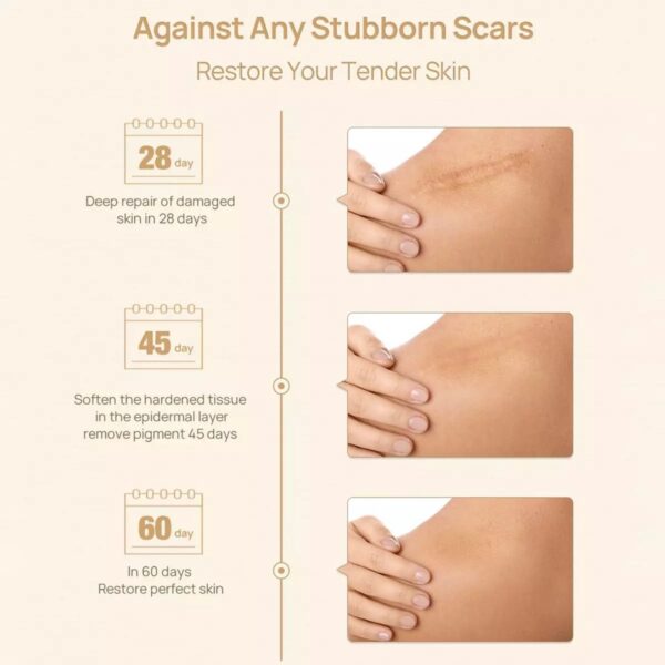 (New)Lanbena  Scar Remover Cream - Image 10