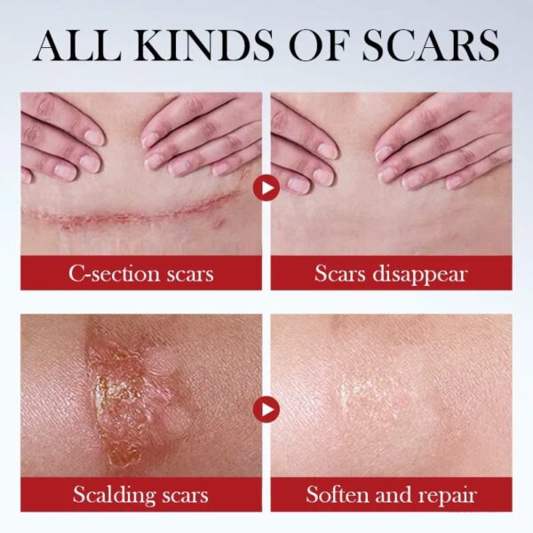 (Original)Sadoer Repair Scar Serum - 40ml - Image 4